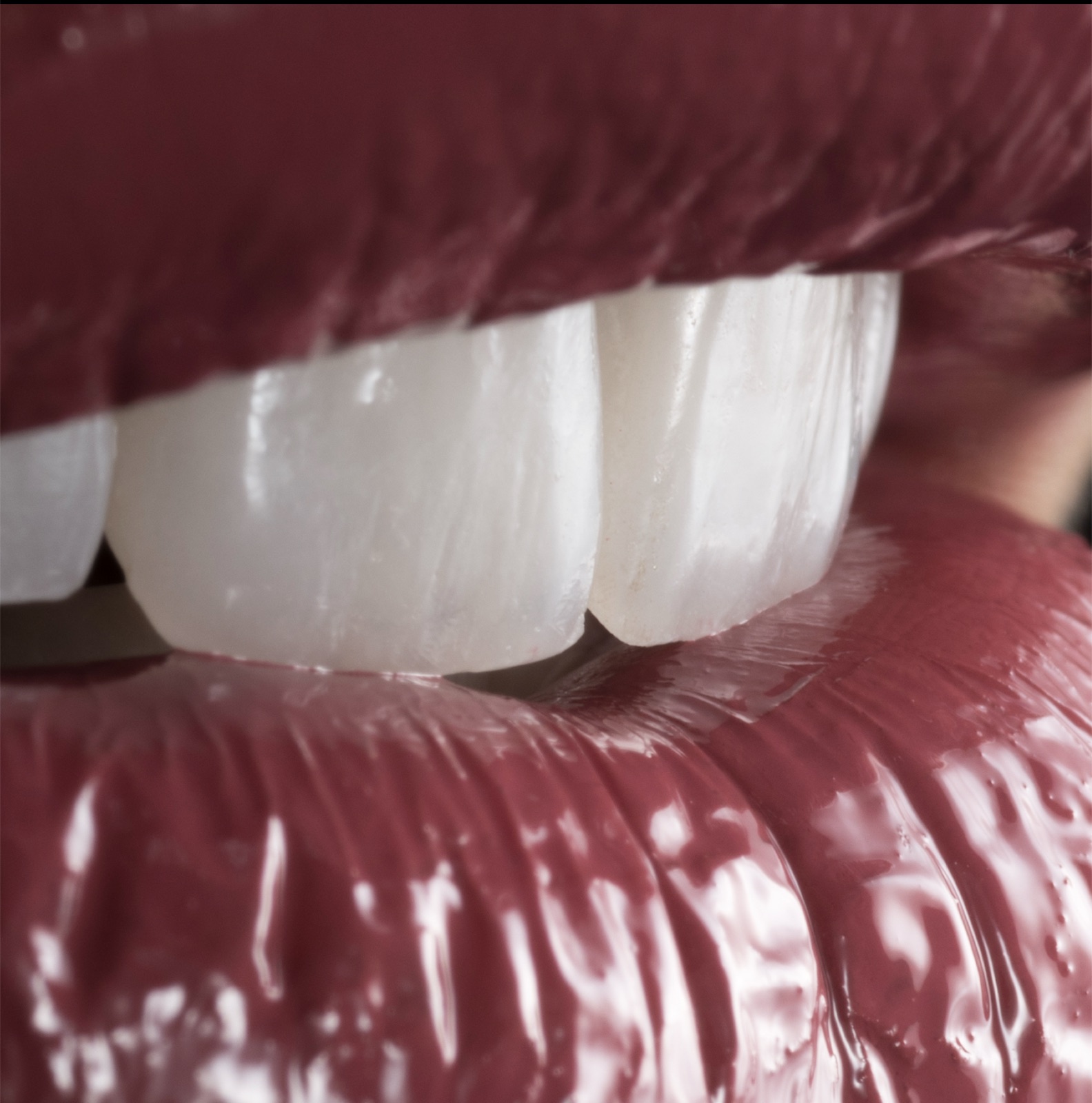 Macro close-up of ceramic veneers by Dr. Succaria showing natural translucency at the edges